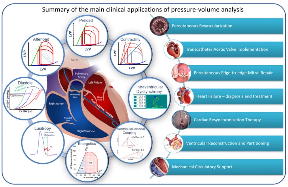 Summary of the main clinical applications of pressure-volume (PV) analysis